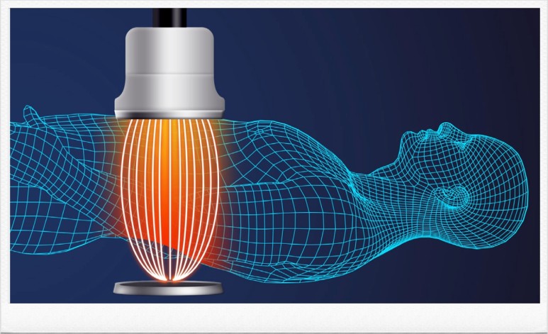 HYPERTHERMIA EKSO 고주파 온열치료기