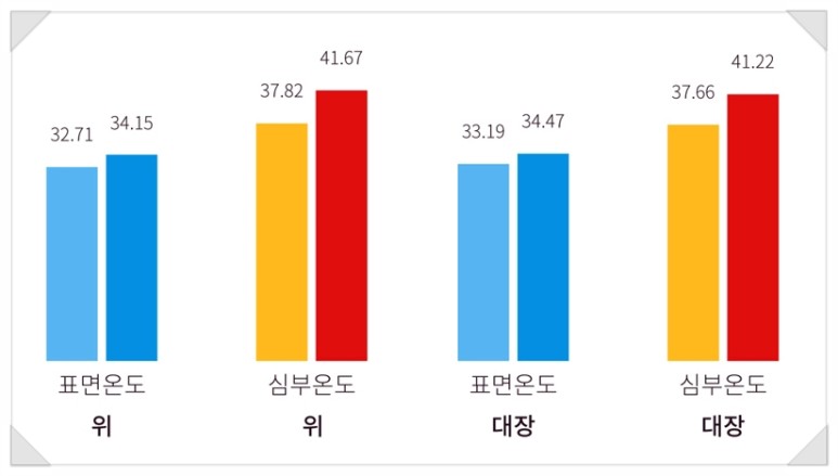 HYPERTHERMIA EKSO 고주파 온열치료기