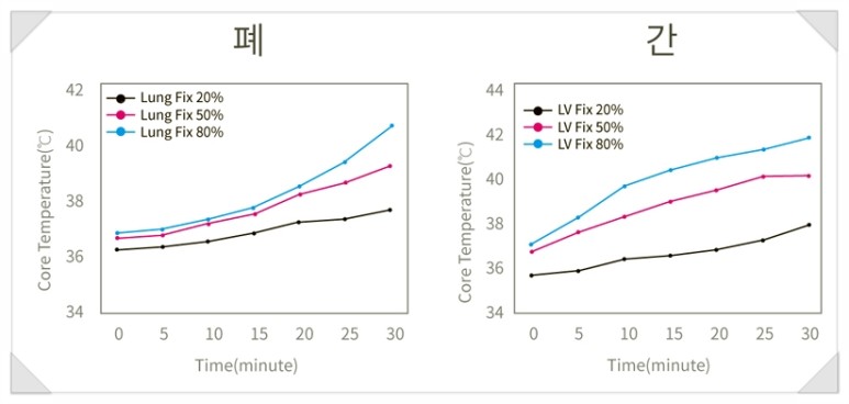 HYPERTHERMIA EKSO 고주파 온열치료기